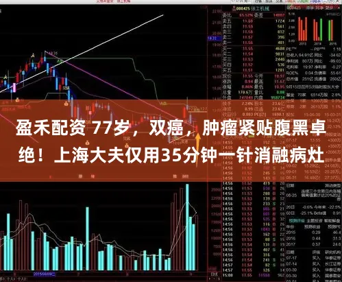 盈禾配资 77岁，双癌，肿瘤紧贴腹黑卓绝！上海大夫仅用35分钟一针消融病灶